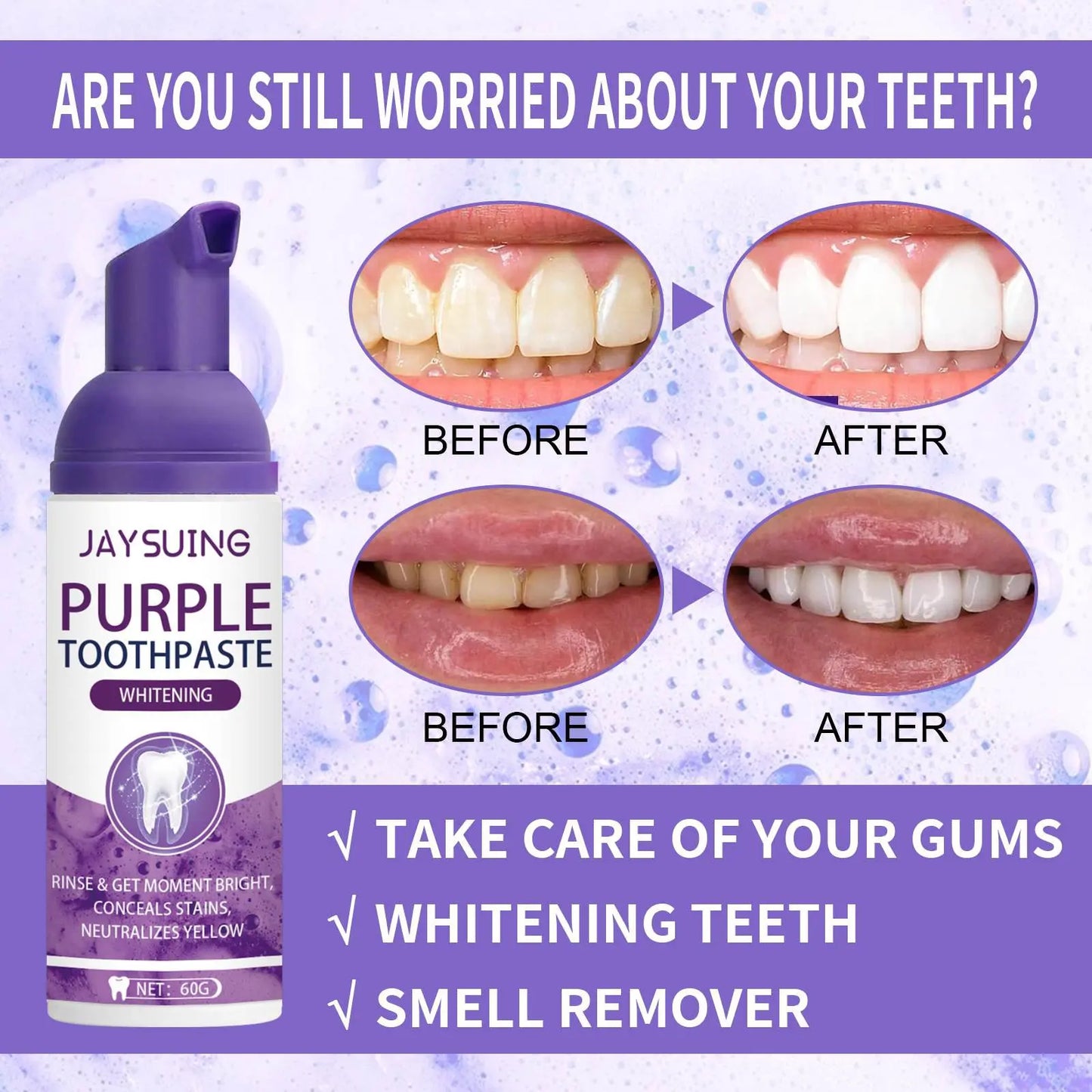 معجون أسنان جايسونغ البنفسجي - ابتسامة أكثر بياضاً وإشراقاً في دبي | العناية بالأسنان في الإمارات العربية المتحدة