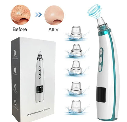 Electric Blackhead Remover - Professional Facial Treatment for Dubai | Home Spa