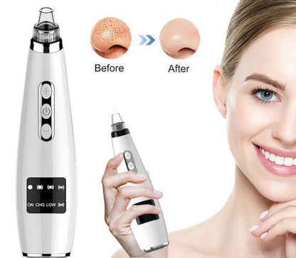 Electric Blackhead Remover - Professional Facial Treatment for Dubai | Home Spa